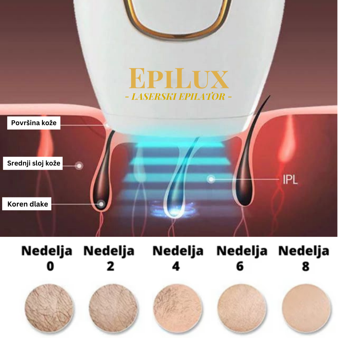 EpiLux Laserski Epilator