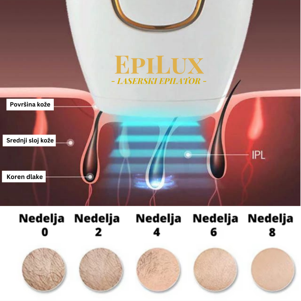 EpiLux Laserski Epilator