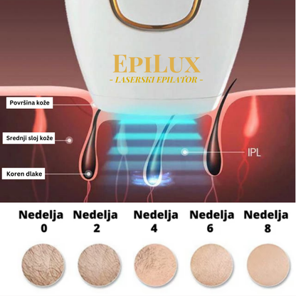 EpiLux Laserski Epilator