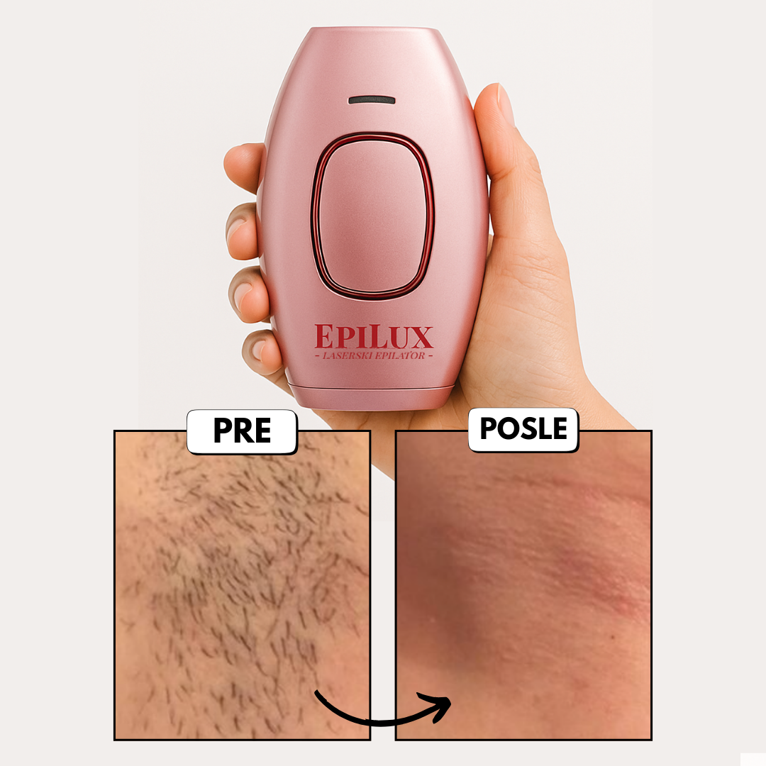 EpiLux Laserski Epilator