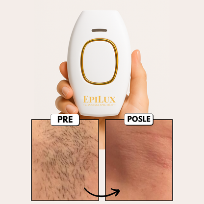 EpiLux Laserski Epilator